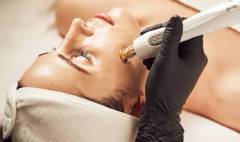 alessi cosmetic surgery - TempSure Skin Tightening