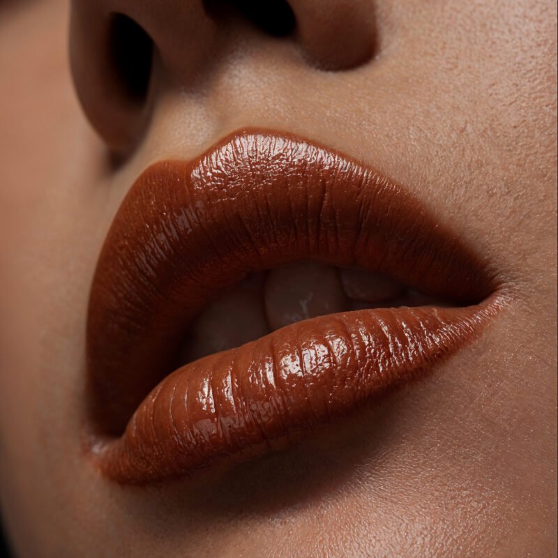 dermal fillers - alessi cosmetic surgery