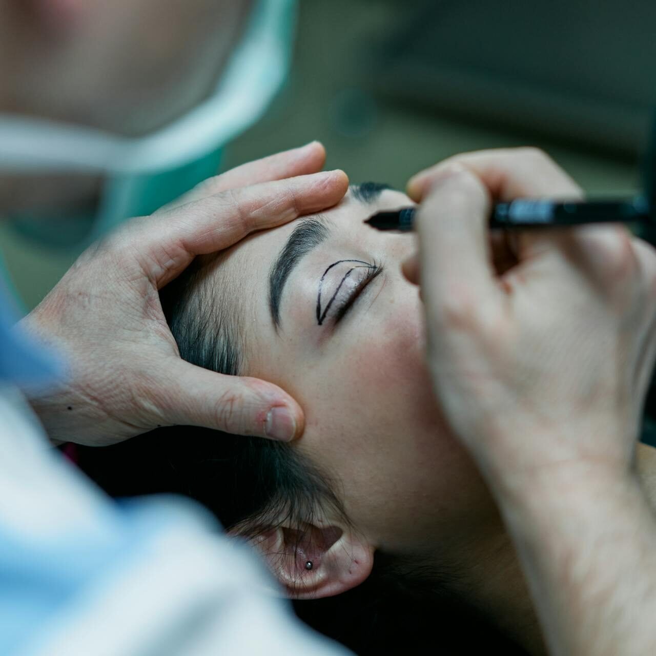 alessi cosmetics Blepharoplasty