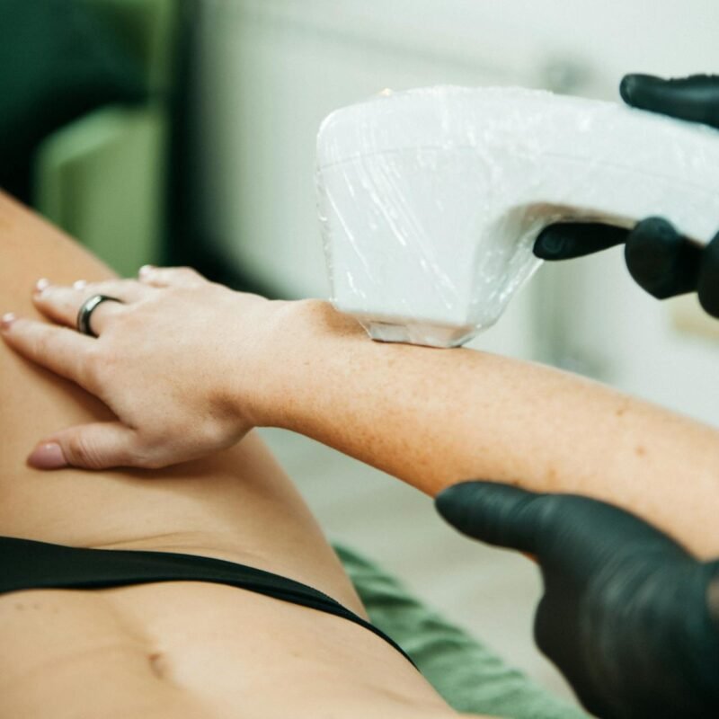 laser hair removal alessi cosmetic surgery