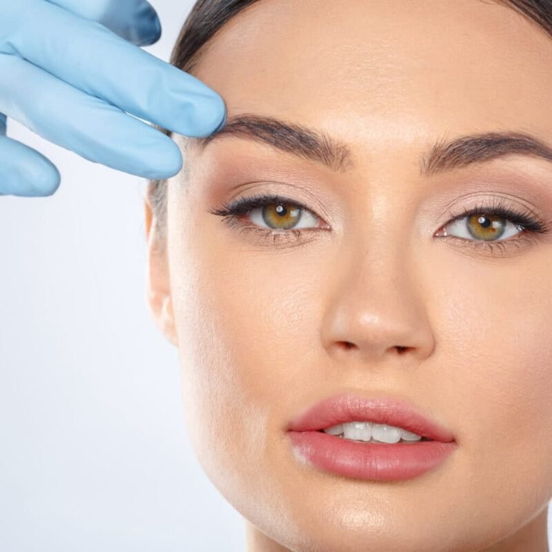 thread lift alessi cosmetic surgery